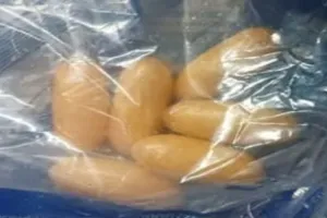 लखनऊ: केजीएमयू के चिकित्सकों ने ऑपरेशन कर अफ्रीकी महिला के पेट से निकाले ड्रग कैप्सूल, अमौसी एयरपोर्ट हुई थी गिरफ्तार