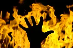 रामपुर: दहेज में 3 लाख नहीं मिले तो महिला को जिंदा जलाने का प्रयास