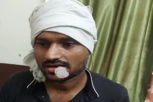 बिजनौर : खेत में काम कर रहे किसान पर गुलदार ने किया हमला, ग्रामीणों में डर का माहौल 