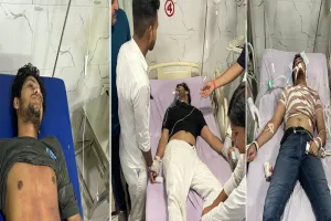 मुरादाबाद: टीएमयू कैंपस में आकाशीय बिजली गिरने से 5 छात्र झुलसे, दो की हालत गंभीर