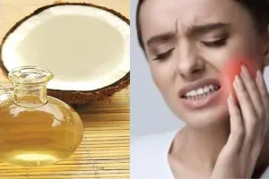 बरेली: क्या आपके दांतों और मसूड़ों में दर्द है? नारियल तेल का ऐसे करें इस्तेमाल मिलेगी राहत