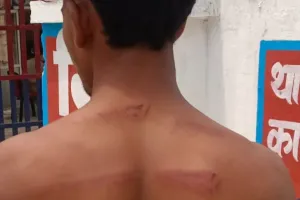 लखीमपुर: रोता-गिड़गिड़ाता रहा युवक बोला- मालिक माफ कर दो...बंधक जमकर पीटा