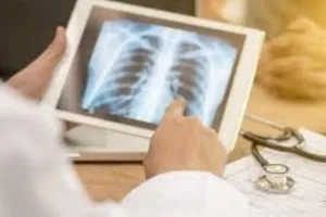 बैंक खाता मांगते ही बिना नैट जांच के लौट रहे है संभावित टीबी मरीज, मरीजों की तलाश में आड़े आ रहा स्वास्थ्य विभाग का आदेश