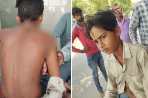 लखीमपुर खीरी: नाना को खेत पर खाना देने जा रहे किशोर पर तेंदुए ने किया हमला