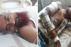 बदायूं: पुरानी रंजिश में फायरिंग से फैली दहशत...प्रधान समेत दो लोगों को लगी गोली