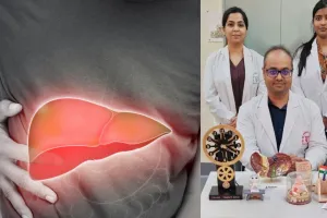 SGPGI के Doctors ने खोजा फैटी लिवर का इलाज, अब नहीं होना पड़ेगा लंबे समय तक परेशान