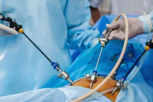 लोहिया संस्थान में दूरबीन से सर्जरी हुई लाइव, डॉक्टरों को किया गया प्रशिक्षित, बोले डॉक्टर- आज के समय में सबसे कारगर