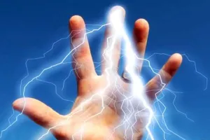 रामपुर: फाल्ट सही करने गया था संविदा कर्मी...करंट का झटका लगने से झुलसा