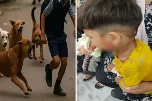 Bareilly: हिंसक कुत्तों के झुंड हो रहे हमलावर...चार साल के मासूम को कई बार काटा