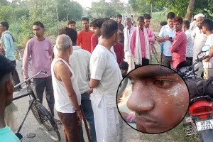 लखीमपुर खीरी: धौरहरा में तेंदुए का आतंक...रिश्तेदारी से लौट रहे युवक पर किया हमला