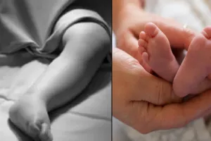 मुरादाबाद : एक साल में बर्थ एस्फिक्सिया से 110 बच्चों की थम गई सांसें