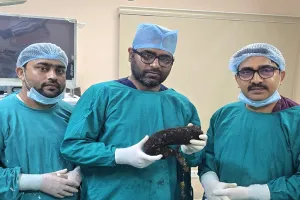 बाल खाने की आदत ने युवती को मौत के मुंह तक पहुंचाया, डॉक्टरों ने कठिन सर्जरी कर बचाई युवती की जान