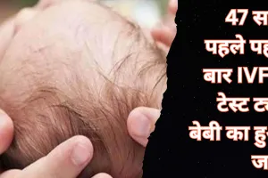 25 जुलाई: 47 साल पहले IVF से पहली बार टेस्ट ट्यूब बेबी का हुआ जन्म