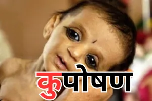 यूपी के बच्चे होंगे कुपोषण मुक्त, आंगनवाड़ी केंद्रों की निगरानी करेंगे 100 नोडल अधिकारी