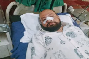 रामपुर: रुपयों के विवाद में मलेरिया विभाग के कर्मचारी को बीच रास्ते पर पीटा