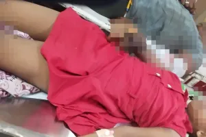 छत पर निकले हाईटेंशन लाइन की चपेट में आकर छात्रा झुलसी... ट्रामा सेंटर में भर्ती, परिजन ने थाने पर दी तहरीर