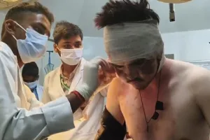 हरदोई: नारियल पानी बेंच रहे किशोर की कनपटी पर बांके से किया हमला, लगे 10 टांके