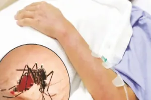 अयोध्या के इस गांव में संक्रामक रोगों का प्रकोप: स्वास्थ्य विभाग ने लगाया कैंप, मलेरिया-डेंगू के मरीज अस्पताल में भर्ती 