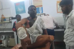 रामपुर : मामूली विवाद में युवक पर पेट्रोल छिड़क कर मंदिर के पुजारी ने लगाई आग, गंभीर रूप से झूलसा