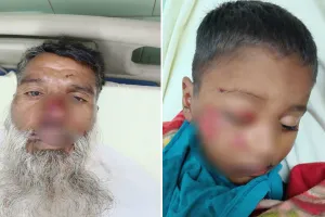 Bareilly: कुत्तों का आतंक बना जानलेवा, हमले में दादा-पोता घायल 
