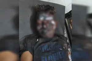 UP : टायर फैक्ट्री में बॉयलर फटने से मजदूर झुलसा, हालत नाजुक, मुरादाबाद रेफर किया गया