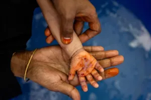 भुखमरी की चपेट में आये 6 देश.. पश्चिमी देशों द्वारा फंडिंग की कटौती के चलते करोड़ों लोगों पर मड़राया खतरा, WFP ने जारी की रिपोर्ट 