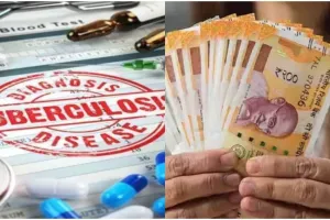 टीबी मरीजों का इंतजार अभी और लंबा... छह माह से नहीं मिल पा रहा पोषण भत्ता
