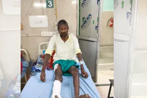 Lucknow News: लावारिस का ऑपरेशन किया, अपने पैसे से लगाया इम्प्लांट