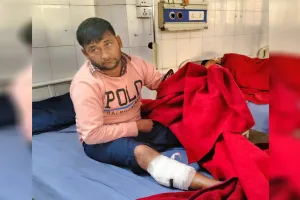 Moradabad: पुलिस ने मुठभेड़ में पकड़ा 50 हजार का इनामी बदमाश