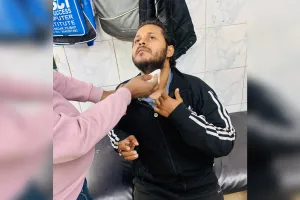 पीलीभीत: प्रतिबंधित चाइनीज मांझा बना मुसीबत, अब रालोद नेता घायल..अचानक गर्दन में आकर फंसा मांझा