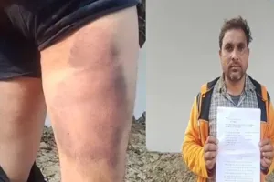 रायबरेली : परशदेपुर पुलिस पर बर्बरता का आरोप, पट्टे से युवक की जमकर पिटाई