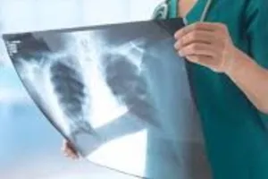 एक पद पर दो एक्स-रे टेक्नीशियन तैनात,  सरकारी धन को कुछ यूं उड़ा रहा स्वास्थ्य विभाग!