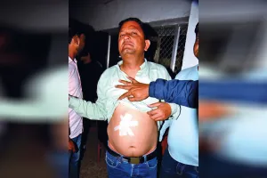 Uttrakhand: रेट्रो साइलेंसर से फोड़े पटाखे, विरोध किया तो गर्दन पर चलाया चाकू