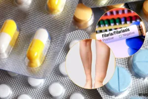 World Lymphedema Day : फाइलेरिया मरीज बने जागरूकता दूत, बीमारी उन्मूलन में निभा रहे अहम भूमिका 