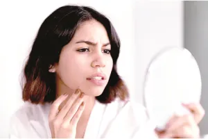 बिना केमिकल के पाएं सॉफ्ट लिप्स