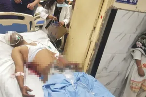 लखनऊ अग्निकांड : जान बचाने को दूसरी मंजिल की खिड़की से जयंत ने लगाई छलांग, कमर में घुस गई सरिया