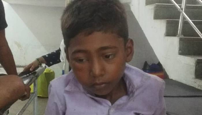 बाराबंकी: विद्यालय की छत से गिरकर किशोर हुआ घायल, अस्पताल में भर्ती