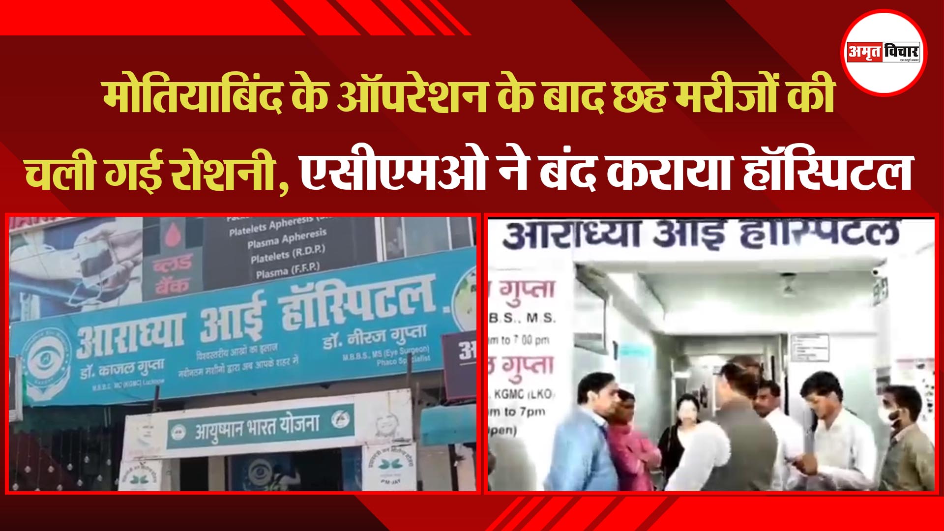 कानपुर: मोतियाबिंद के ऑपरेशन के बाद छह मरीजों की चली गई रोशनी, एसीएमओ ने बंद कराया हॉस्पिटल