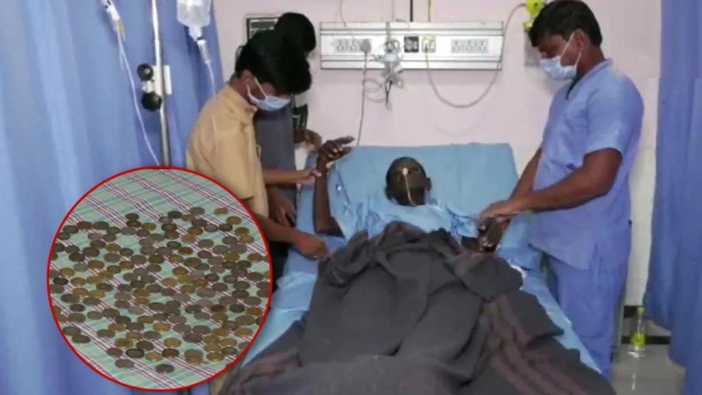 58 साल के मरीज के पेट से निकाले 187 सिक्के, डॉक्टर भी हैरान 
