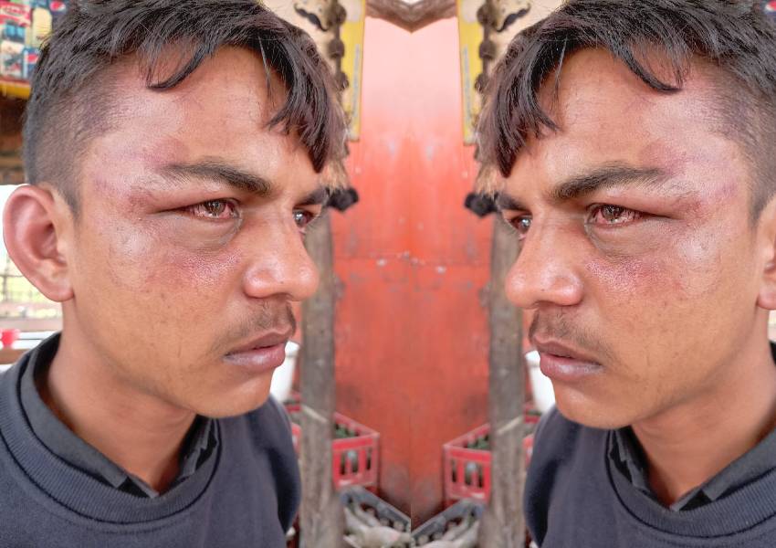 सुलतानपुर: पिस्टल की बट से युवक को पीटकर किया लहूलुहान, चार दबंगों पर केस दर्ज 