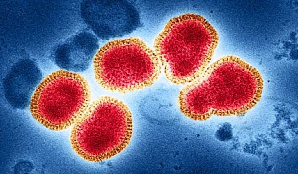 सावधानी बरतें, एच3एन2 वायरस से घबराने की आवश्यकता नहीं: विशेषज्ञ 