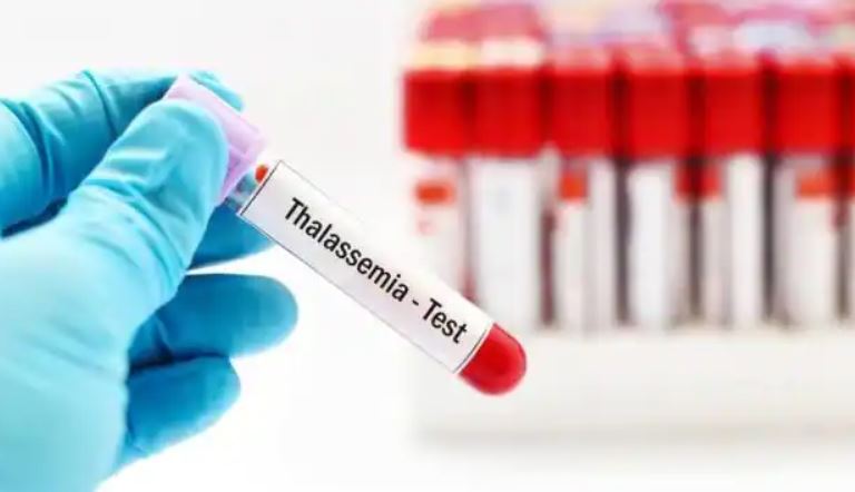 बरेली: थैलेसीमिया की दवा नहीं कर रही असर, खून में बढ़ रहा आयरन