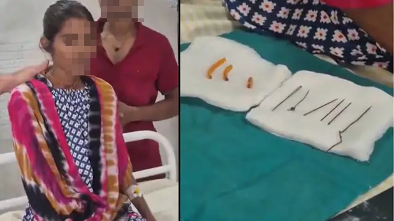 Prayagraj News : पेट से निकलीं छह सुइयां, हेयर पिन और कांच के टुकड़े, इस दुर्लभ बीमारी से पीड़ित थी महिला Prayagraj News : पेट से निकलीं छह सुइयां, हेयर पिन और कांच के टुकड़े, इस दुर्लभ बीमारी से पीड़ित थी महिला