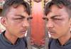 सुलतानपुर: पिस्टल की बट से युवक को पीटकर किया लहूलुहान, चार दबंगों पर केस दर्ज 