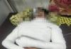 सीतापुर: शादी समारोह में ज़िंदा जला गया युवक, गंभीर हालत में ट्रामा सेंटर में भर्ती 