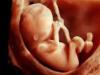 मारपीट से गर्भवती के गर्भ में शिशु की मौत, मुकदमा दर्ज होने के बाद आरोपी फरार