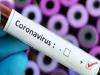 नैनीताल: एनसीसी कैडेट कोरोना संक्रमित