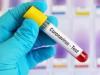 ICMR एडवाइजरी: पुरानी बीमारी, गंध और स्वाद की समस्या हो तो जरूर कराएं कोविड टेस्ट