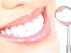 Healthy teeth : कमजोर दांतों के लिए अपनाएं यह घरेलू उपाय, जल्द दिखेगा असर