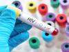 कम्प्युटर मॉडलिंग से मिलेगी एचआईवी टीके की खोज में मदद